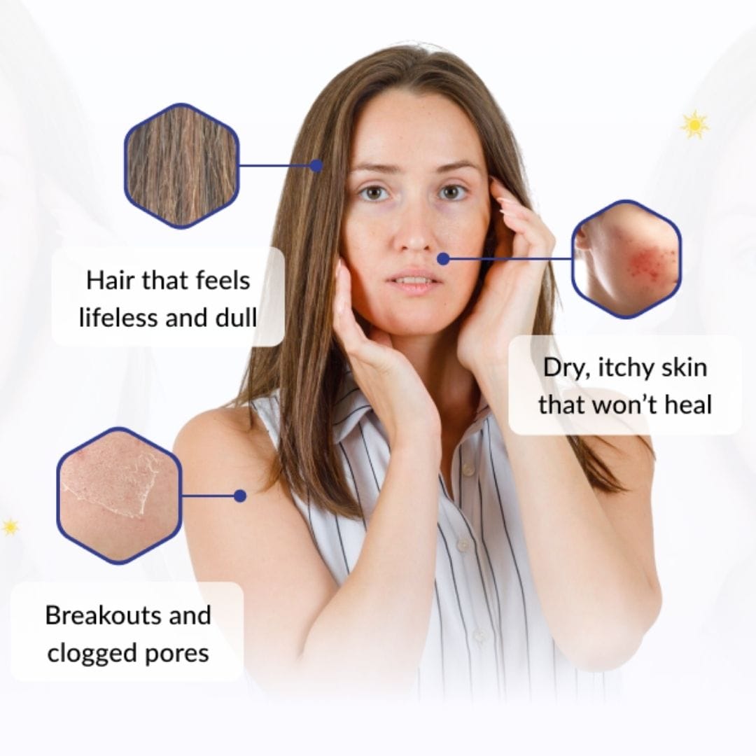 Woman with skin issues highlighted by icons and text on a white background
